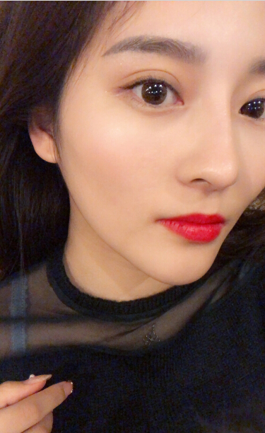 1520318900744255.jpg 張家港唯恩整形醫(yī)院陳天杰醫(yī)生切開(kāi)雙眼皮案例效果對(duì)比圖