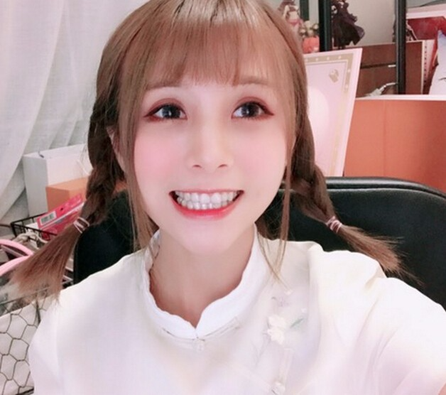 廣州德倫口腔醫(yī)生程武做隱形托槽矯正怎么樣？附隱形托槽矯正案例效果對(duì)比圖