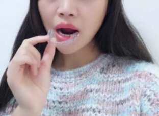 廈門拜博口腔醫(yī)院醫(yī)生張忠做牙齒隱形矯正怎么樣？附案例效果對比圖