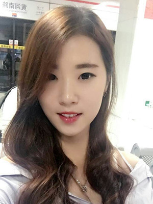 北京貴美匯整形醫(yī)院上田寬醫(yī)生做雙眼皮案例效果對比圖