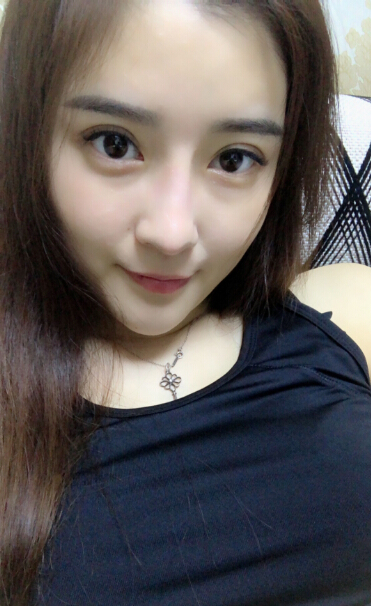 1520318883987275.jpg 張家港唯恩整形醫(yī)院陳天杰醫(yī)生切開(kāi)雙眼皮案例效果對(duì)比圖