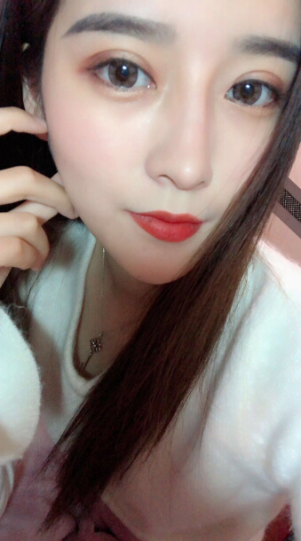 1520318875291335.jpg 張家港唯恩整形醫(yī)院陳天杰醫(yī)生切開(kāi)雙眼皮案例效果對(duì)比圖