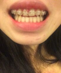 1519377121110557.jpg 1519377121110557.jpg