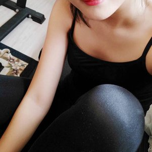 岳陽愛思特醫(yī)療美容醫(yī)院醫(yī)生王福生做手臂吸脂怎么樣？附案例效果圖