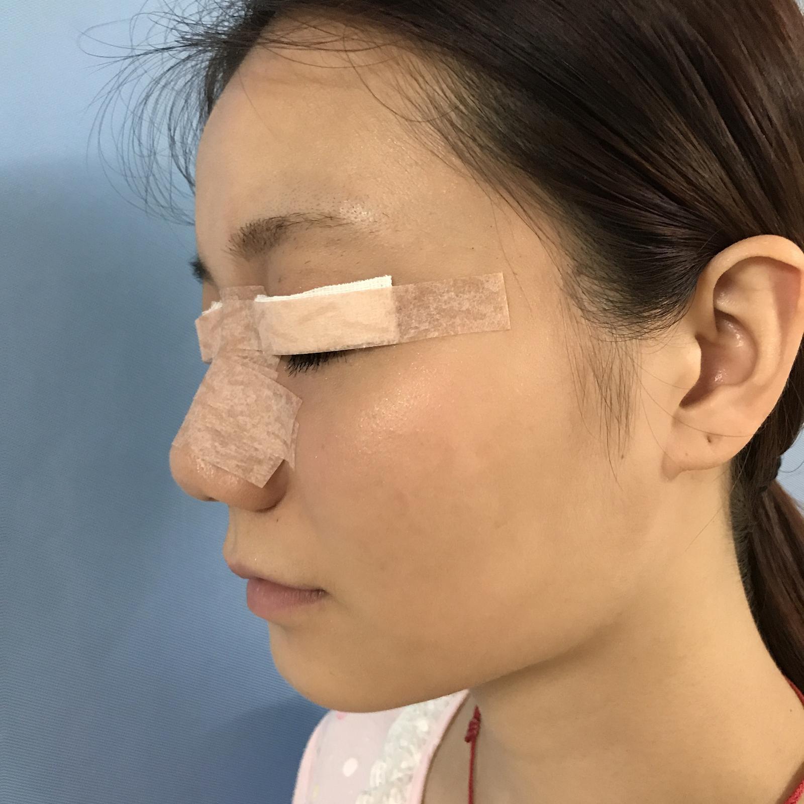 武漢華美整形醫(yī)院醫(yī)生王向陽(yáng)做眼綜合整形怎么樣？附案例效果圖