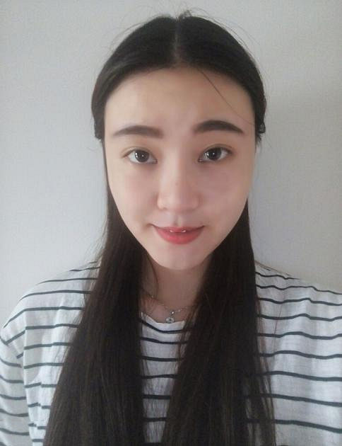 深圳陽光整形美容醫(yī)院醫(yī)生張平做膨體隆鼻+雙眼皮+注射瘦臉案例效果對(duì)比圖