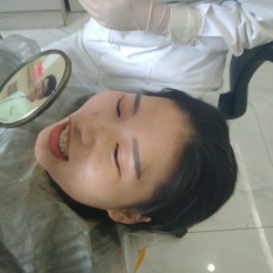 洛陽(yáng)友好口腔醫(yī)院醫(yī)生李新然做牙貼面怎么樣？附案例效果圖