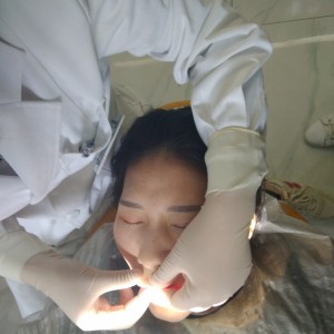 黔西南興義京州口腔醫(yī)院醫(yī)生徐勇做牙貼面怎么樣？附案例效果對(duì)比圖