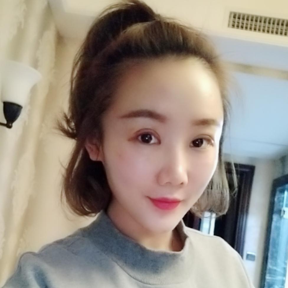 1527835698343657.jpg 上海首爾麗格整形醫(yī)院醫(yī)生唐鏖做眼綜合+自體脂肪全臉填充案例效果對比圖