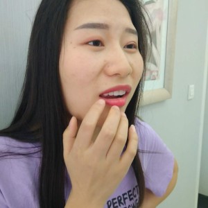 黔西南興義京州口腔醫(yī)院醫(yī)生徐勇做牙貼面怎么樣？附案例效果對(duì)比圖