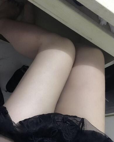 上海保加醫(yī)療美容門診部做大腿吸脂怎么樣？附楊勇醫(yī)生案例效果對比圖