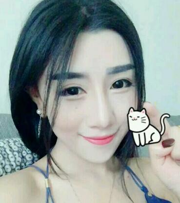 貴陽泰康樂醫(yī)院整形美容科醫(yī)生陳璐做自體脂肪全臉填充效果怎么樣？