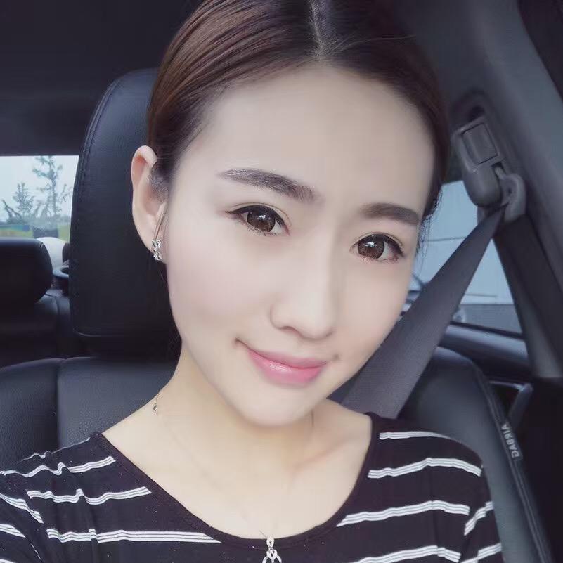 貴陽美和諧醫(yī)療整形醫(yī)生孫澤芳做切開雙眼皮效果怎么樣？附案例效果對比圖