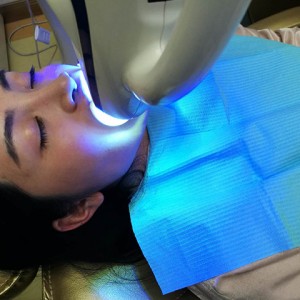 上?？仆呖谇会t(yī)院醫(yī)生鄧建儒做牙齒冷光美白怎么樣？附案例效果對比圖