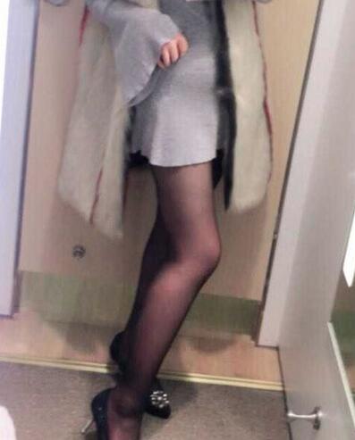 上海保加醫(yī)療美容門診部做大腿吸脂怎么樣？附楊勇醫(yī)生案例效果對比圖