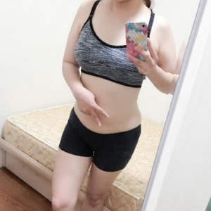 北京可思美整形醫(yī)院醫(yī)生斯勤做腰腹吸脂怎么樣？附案例效果對比圖