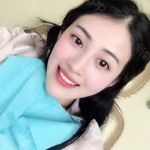 上?？仆呖谇会t(yī)院醫(yī)生鄧建儒做牙齒冷光美白怎么樣？附案例效果對比圖