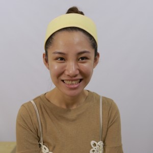 保定東陽口腔醫(yī)院醫(yī)生白小青做牙齒冷光美白怎么樣？附案例效果對比圖