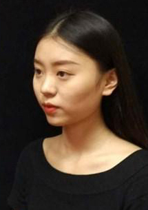 長沙星雅醫(yī)療美容醫(yī)院醫(yī)生陳煥武做埋線提升怎么樣？