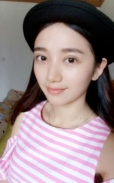 長治松禾醫(yī)療美容診所醫(yī)生馬俊峰做韓式微創(chuàng)定點雙眼皮效果怎么樣？附案例