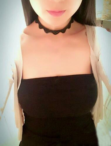 海南伊佳醫(yī)療美容醫(yī)院醫(yī)生涂陽君做假體隆胸怎么樣？附案例效果對(duì)比圖