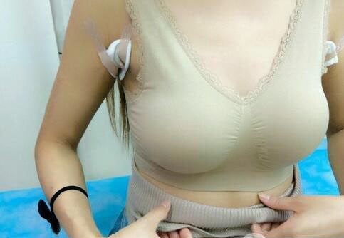 海南伊佳醫(yī)療美容醫(yī)院醫(yī)生涂陽君做假體隆胸怎么樣？附案例效果對(duì)比圖