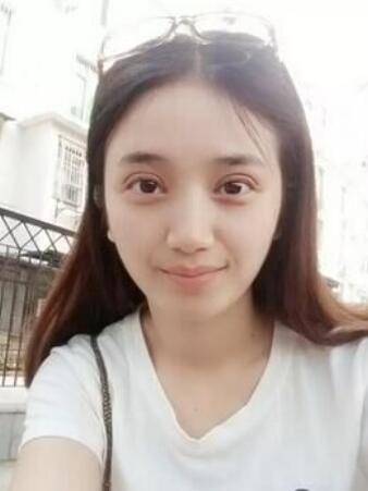 長治松禾醫(yī)療美容診所醫(yī)生馬俊峰做韓式微創(chuàng)定點雙眼皮效果怎么樣？附案例