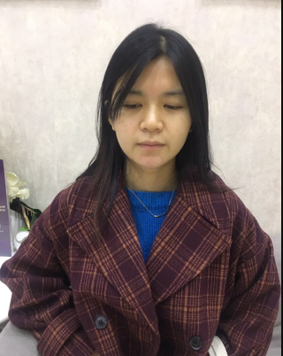 上海時(shí)光整形外科醫(yī)院醫(yī)生何晉龍做假體隆胸怎么樣？附案例效果對(duì)比圖