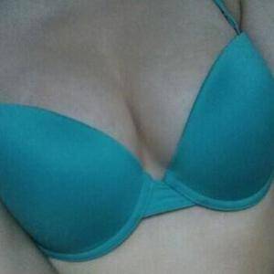 河南協(xié)和醫(yī)院整形外科醫(yī)生騰利做自體脂肪隆胸怎么樣？附案例效果對(duì)比圖