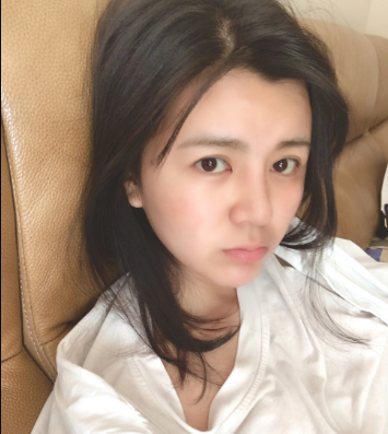 上海時(shí)光整形外科醫(yī)院醫(yī)生何晉龍做假體隆胸怎么樣？附案例效果對(duì)比圖