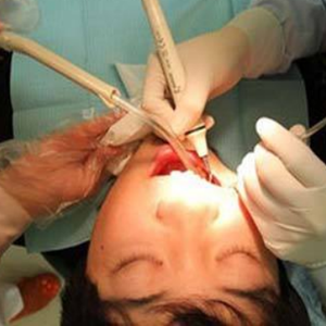 淄博口腔醫(yī)院醫(yī)生牟象鑫做超聲波洗牙怎么樣？附案例效果對比圖