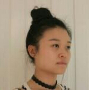 鄭州管城中醫(yī)院整形美容中心醫(yī)生張秀英做注射瘦臉怎么樣？附除皺瘦臉案例效果圖