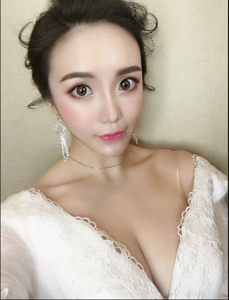 重慶當(dāng)代整形美容醫(yī)院醫(yī)生楊健做假體隆胸怎么樣？附案例