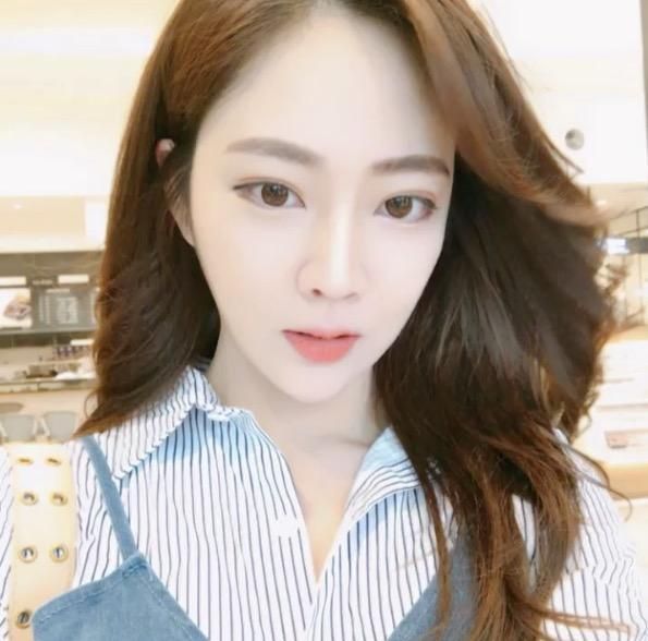 廣州中科美整形醫(yī)院醫(yī)生鄭志敏做鼻部多項(xiàng)綜合整形怎么樣？附案例效果圖