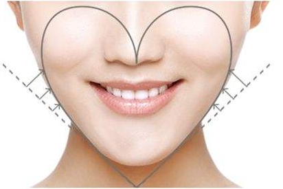 成都濟(jì)慈德美醫(yī)療美容門診部下頜角整形