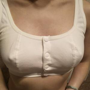 長(zhǎng)沙亞韓醫(yī)學(xué)美容醫(yī)院醫(yī)生鄭京湘做假體隆胸怎么樣？附醫(yī)生案例效果對(duì)比圖