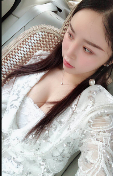 吉林現(xiàn)代整形美容醫(yī)院做假體隆胸效果怎么樣？附醫(yī)院案例效果對(duì)比圖