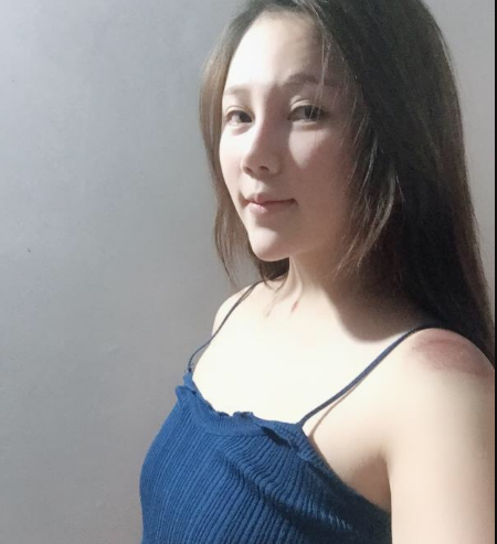 北京東方和諧醫(yī)療整形診所馮斌醫(yī)生做假體隆胸怎么樣？附案例效果對(duì)比圖