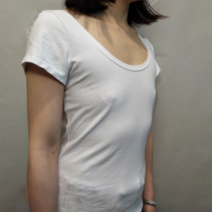 長(zhǎng)沙亞韓醫(yī)學(xué)美容醫(yī)院醫(yī)生鄭京湘做假體隆胸怎么樣？附醫(yī)生案例效果對(duì)比圖