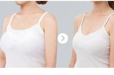 成都濟(jì)慈德美醫(yī)療美容門(mén)診部巨乳縮小