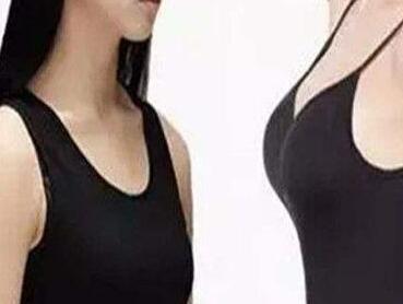 福州曙光整形美容醫(yī)院自體脂肪豐胸