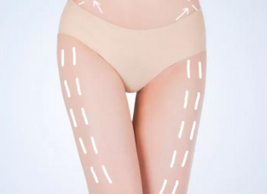 杭州格萊美整形美容醫(yī)院大腿吸脂