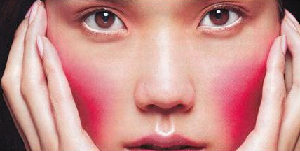 濟(jì)南美容整形醫(yī)院激光祛紅血絲