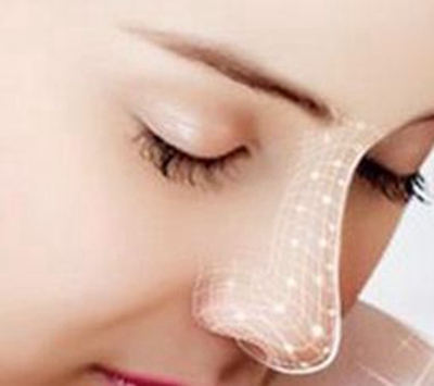 廈門莫琳娜醫(yī)療美容門診部自體軟骨隆鼻