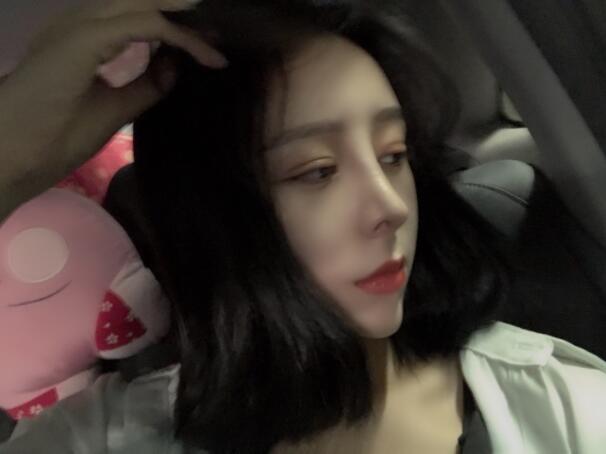 上海時光整形外科醫(yī)院雙眼皮+隆鼻+下頜角案例