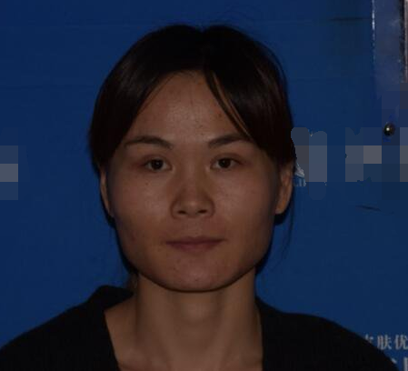 上海時光整形醫(yī)生何晉龍做下頜角磨骨術(shù)前術(shù)后案例效果對比圖 上海時光整形醫(yī)生何晉龍做下頜角磨骨術(shù)前術(shù)后案例效果對比圖