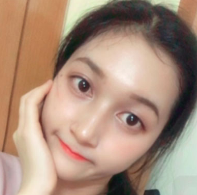 上海時(shí)光整形醫(yī)院做面部玻尿酸注射效果怎么樣？