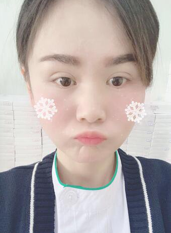 上海時光整形醫(yī)生何晉龍做下頜角磨骨術(shù)前術(shù)后案例效果對比圖 上海時光整形醫(yī)生何晉龍做下頜角磨骨術(shù)前術(shù)后案例效果對比圖