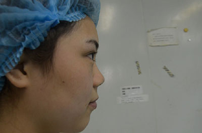 合肥韓美整形醫(yī)院做隆鼻手術(shù)效果怎么樣?附金壽信醫(yī)生案例 合肥韓美整形醫(yī)院做隆鼻手術(shù)效果怎么樣?附金壽信醫(yī)生案例