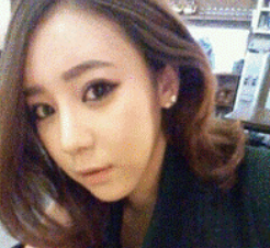 上海時光整形醫(yī)生何晉龍做假體隆鼻效果怎么樣？附案例效果對比圖